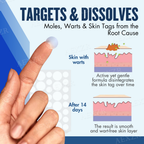 Parche – Eliminación efectiva de manchas de belleza y verrugas