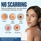 Parche – Eliminación efectiva de manchas de belleza y verrugas