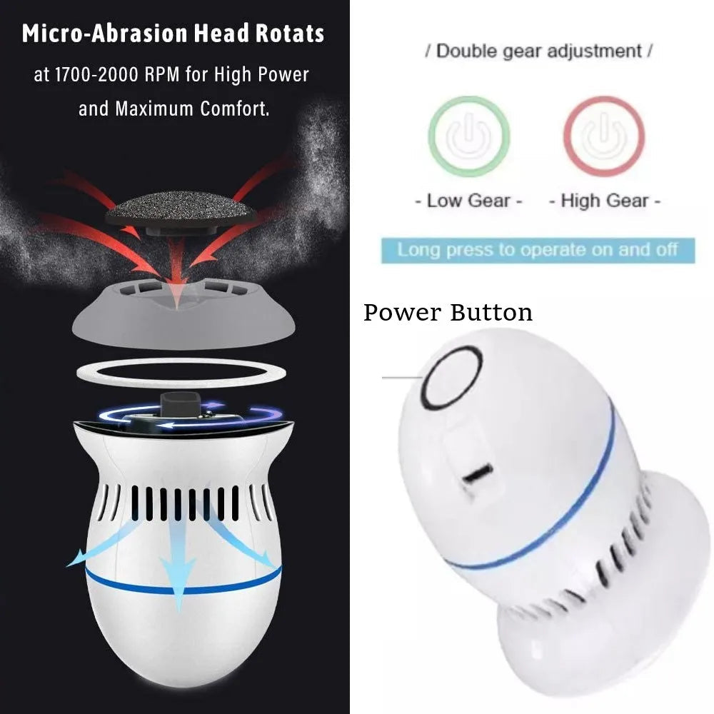 Removedor de callos eléctricos