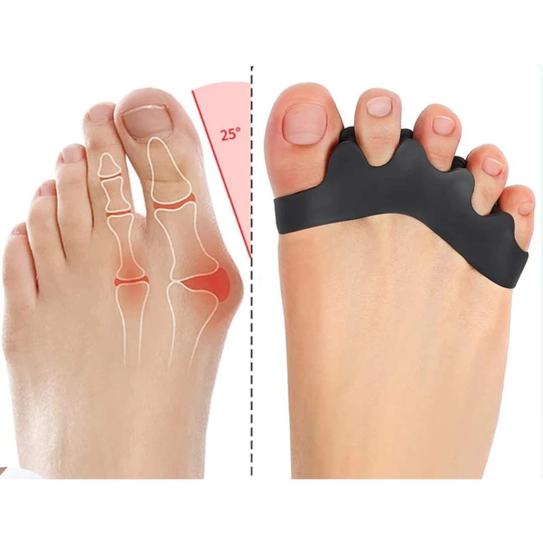 Separador de Dedos FlexAlign | Realineación de Dedos y Alivio del Dolor – Ideal para Juanetes - Dedos Superpuestos - y Comodidad en los Pies